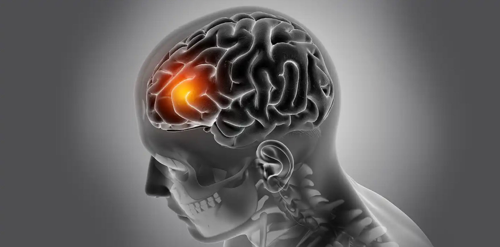 Brain Tumor Detection Using Deep Learning | 999 Projects