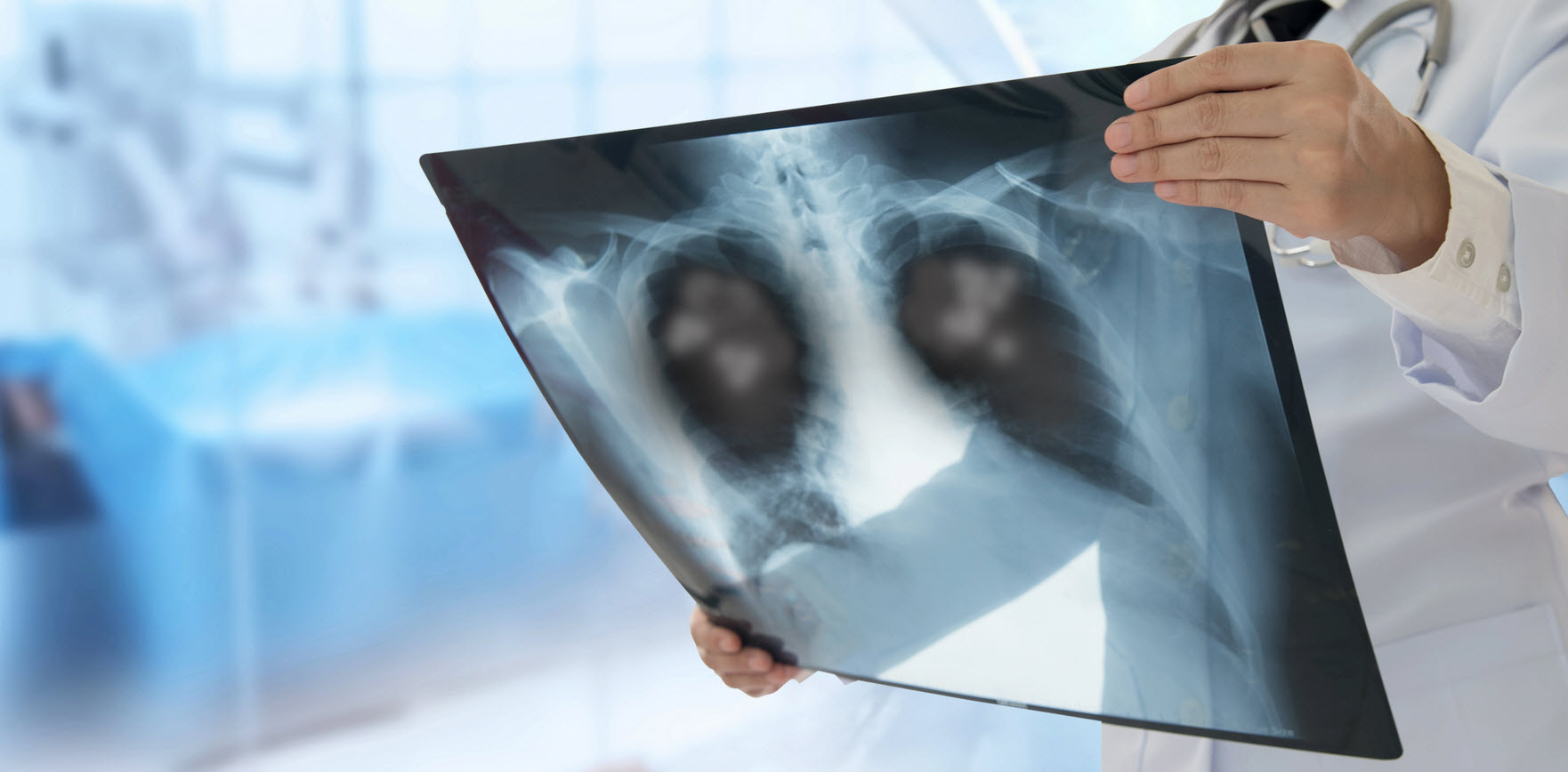 Pneumonia Detection From Chest X-ray Image | 999 Projects